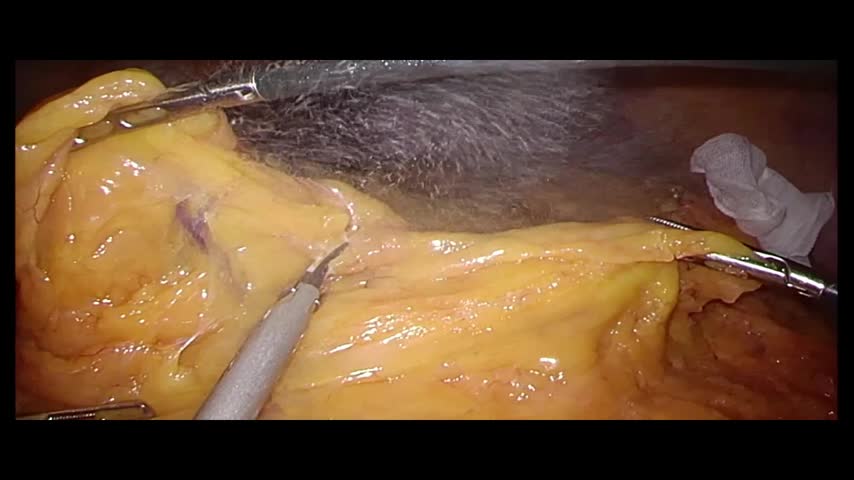 73-11-192大塚論文　動画２