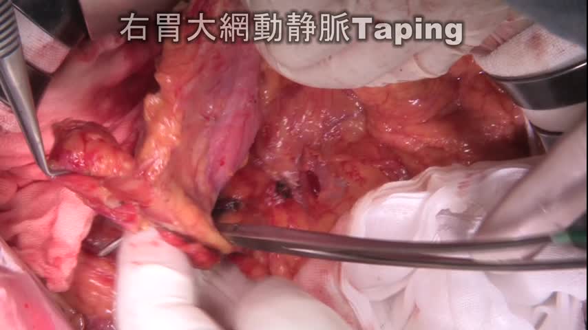 73-11-391岡田論文　図2，3，5
