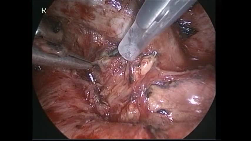 73-11-043大杉論文　動画３