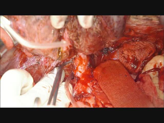 73-11-272阪本論文　動画2（図1c,d）