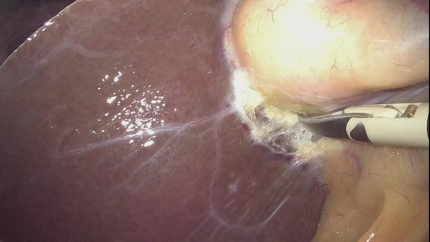 73-11-312 尾崎論文　図3，4