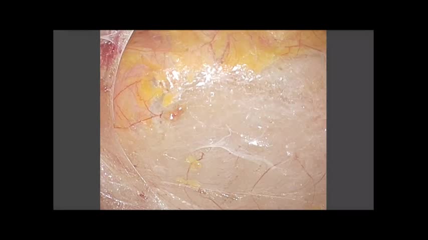73-11-412朝蔭論文　図7動画1