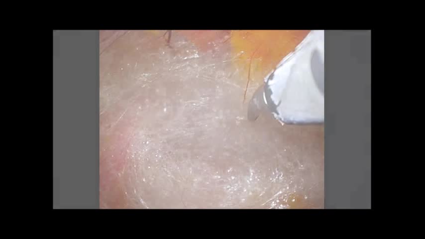 73-11-413朝蔭論文　図7動画2