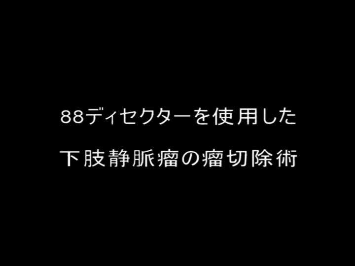 図３　88ディセクターを使用した下肢静脈瘤の瘤切除術...