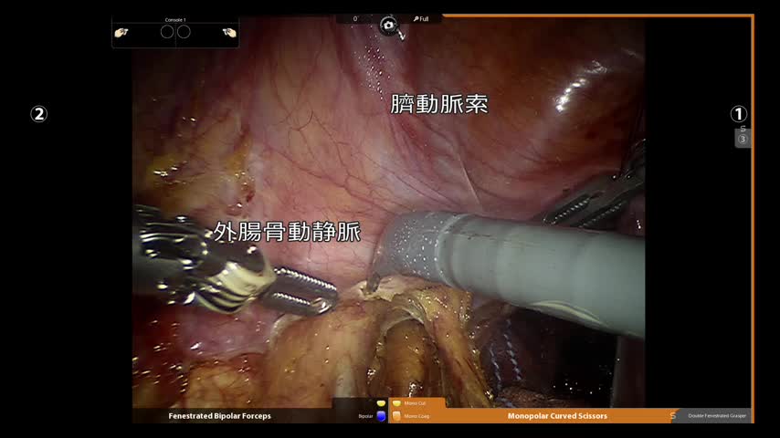 73-11-152石部論文　図2