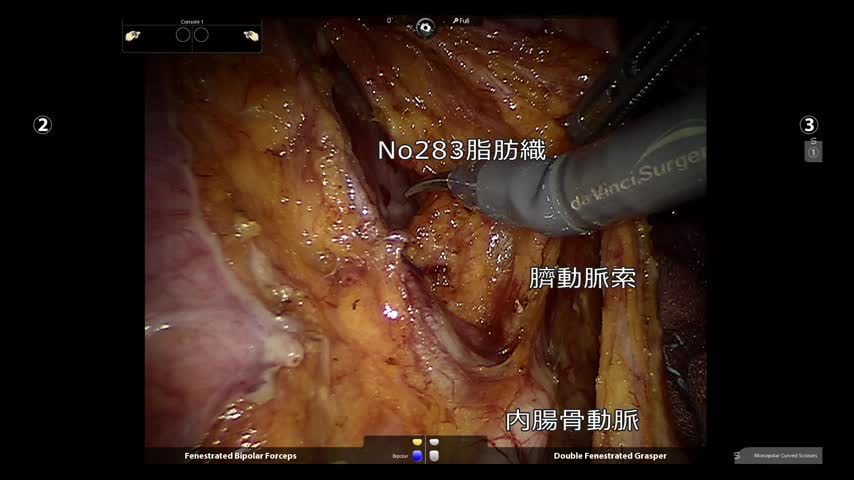73-11-153石部論文　図3