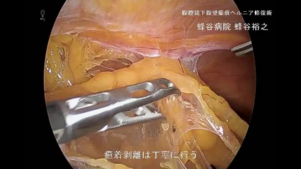 76-07蜂谷論文　動画１   図２　