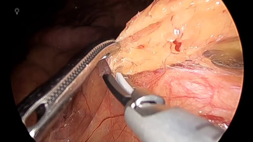 76-11-152塚本論文　動画2図3