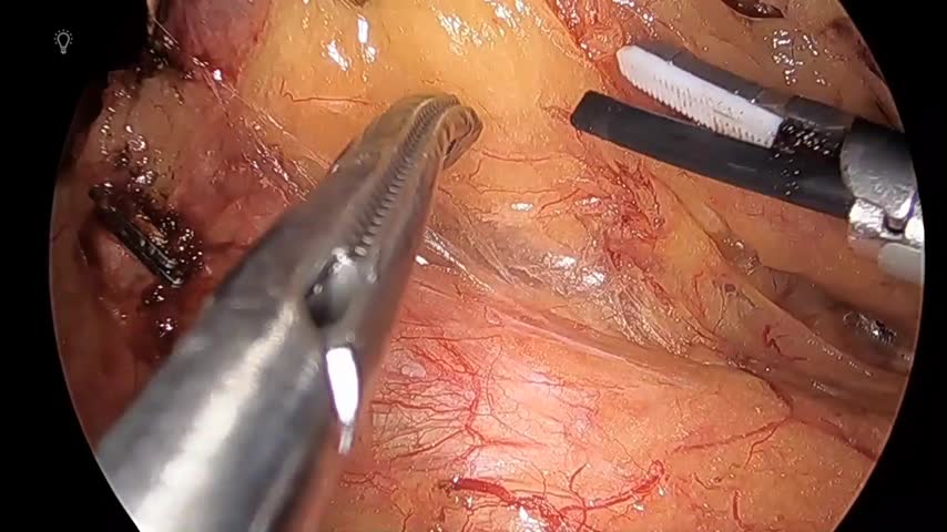 76-11-153塚本論文　動画3図4