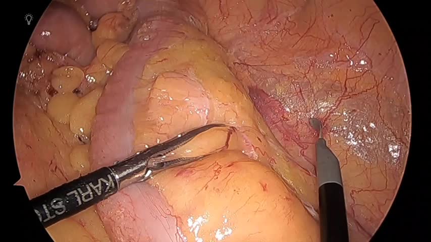 76-11-154塚本論文　動画4図5