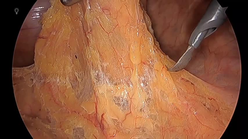 76-11-155塚本論文　動画5図6