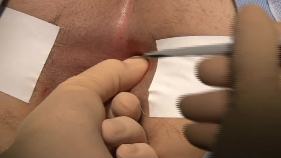 76-11-222栗原論文　図２