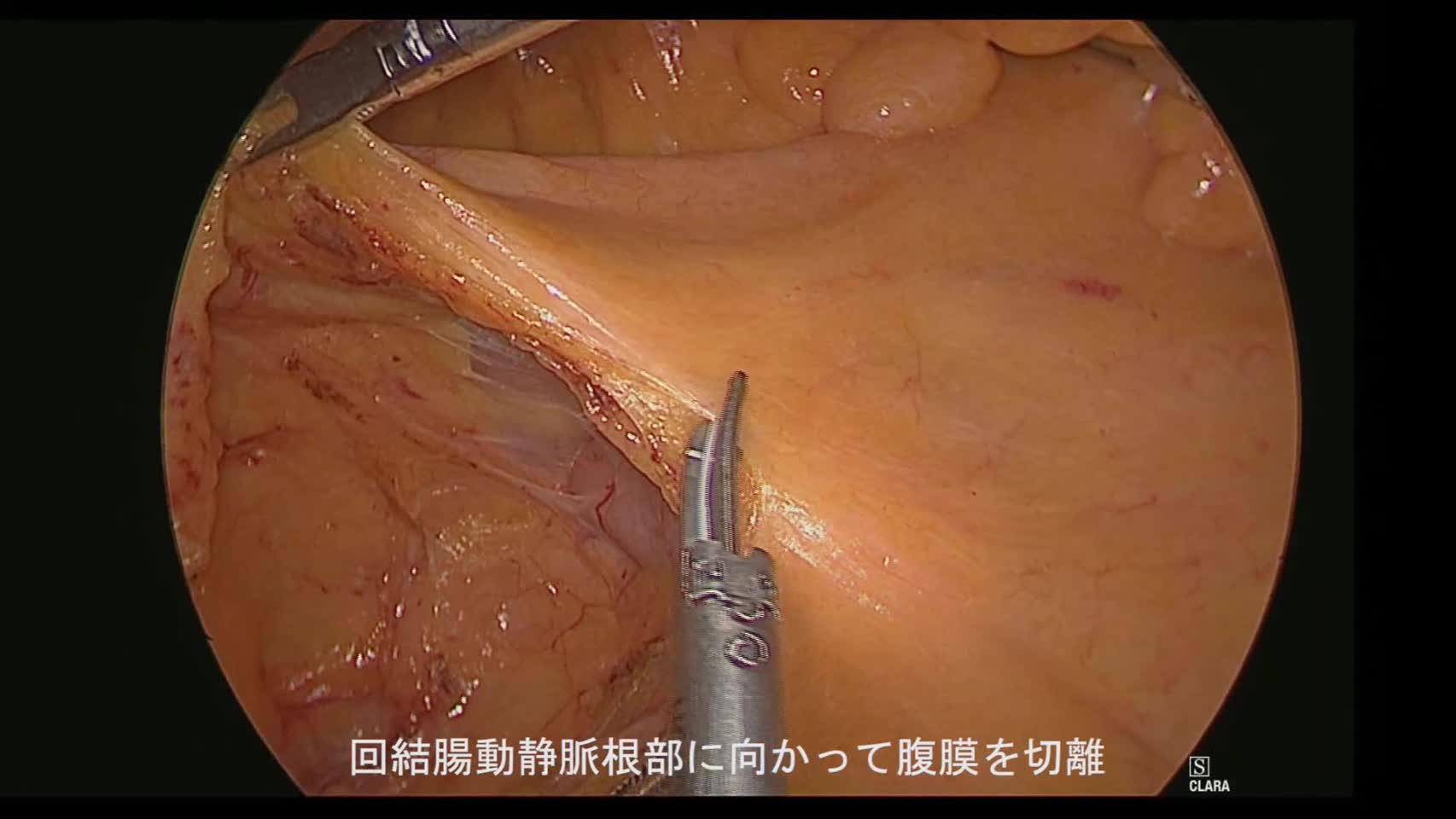 76-11-132櫻井論文　動画2図3