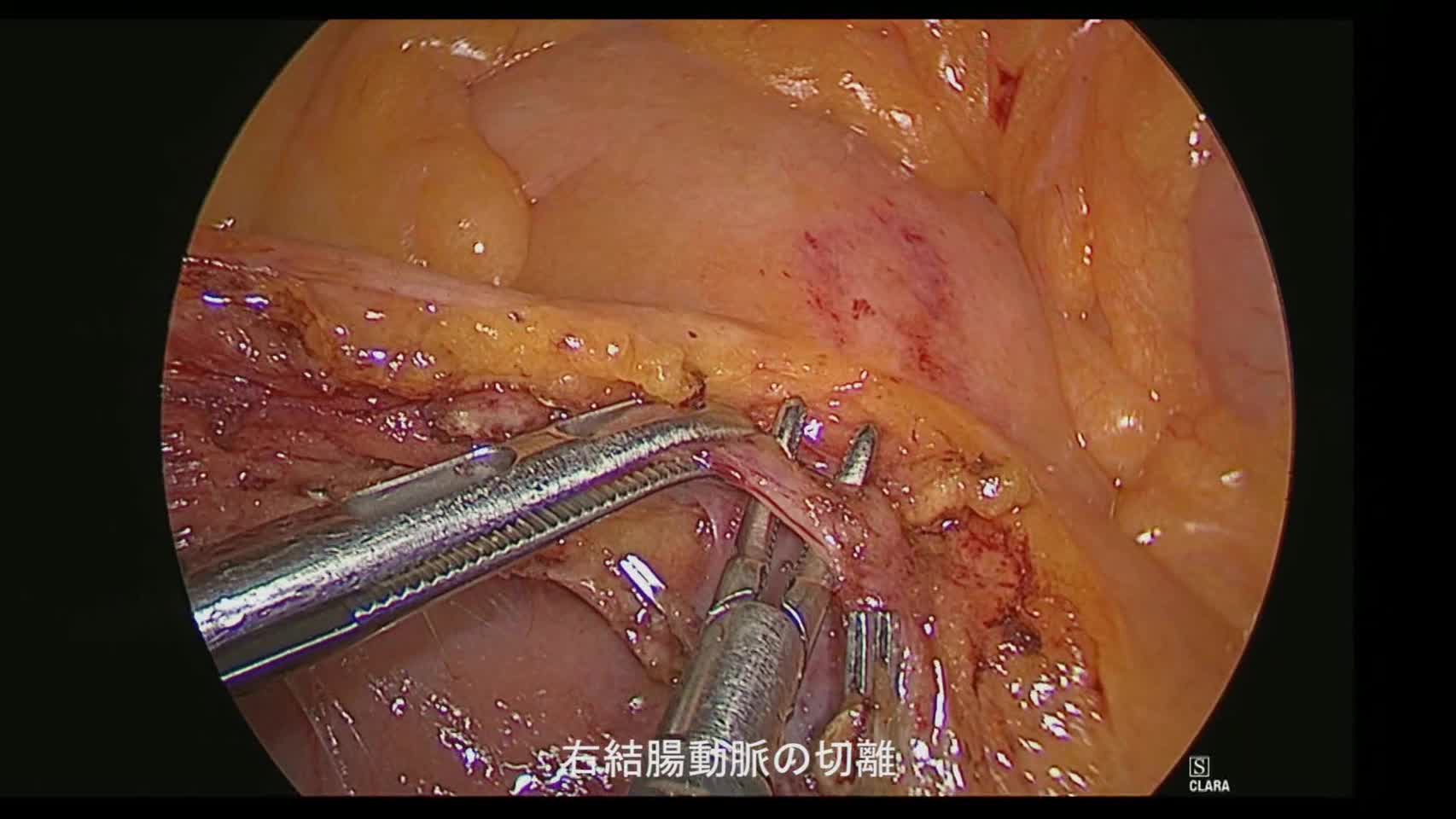 76-11-133櫻井論文　動画3図4