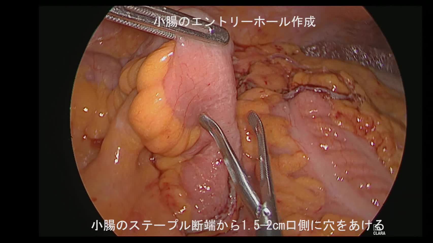 76-11-136櫻井論文　動画6図7