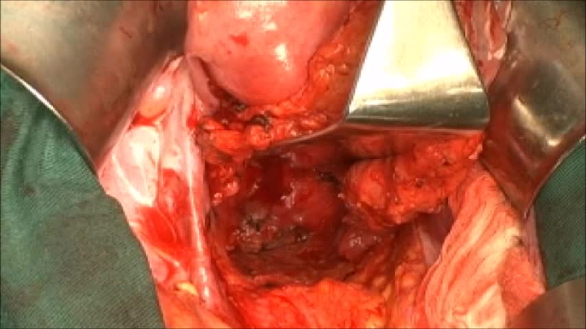 76-11-181小森論文　動画1図2a
