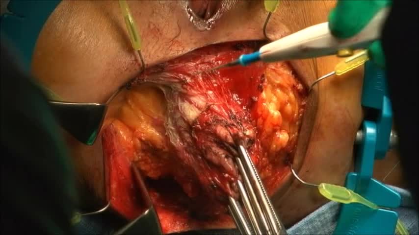 76-11-186小森論文　動画6図8