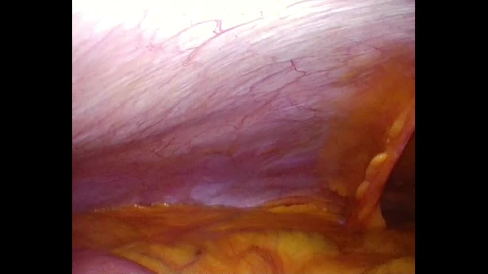76-11-386梅邑論文　動画６