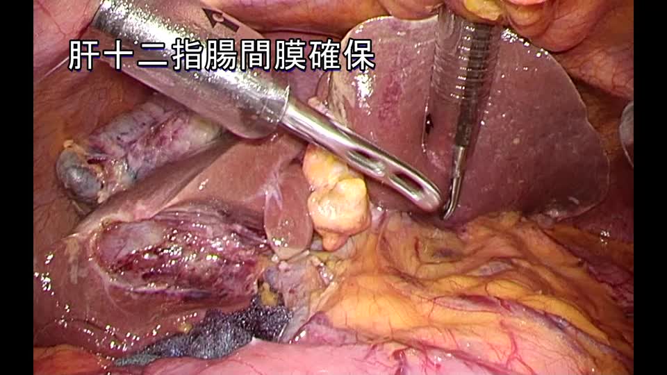 76-11-251石川論文　図１