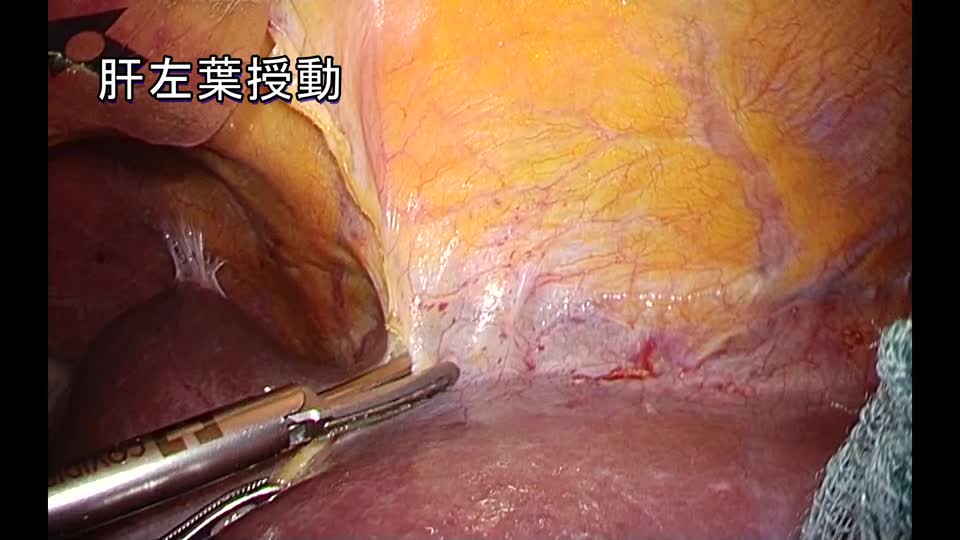 76-11-252石川論文　図２