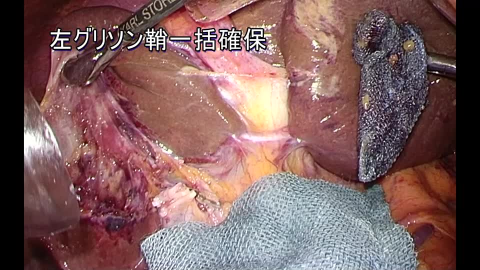 76-11-253石川論文　図３