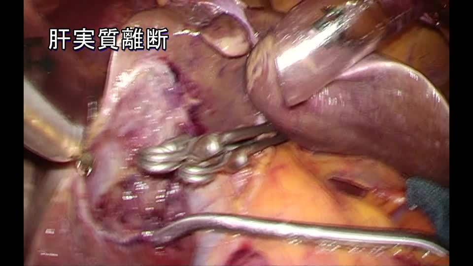 76-11-254石川論文　図４