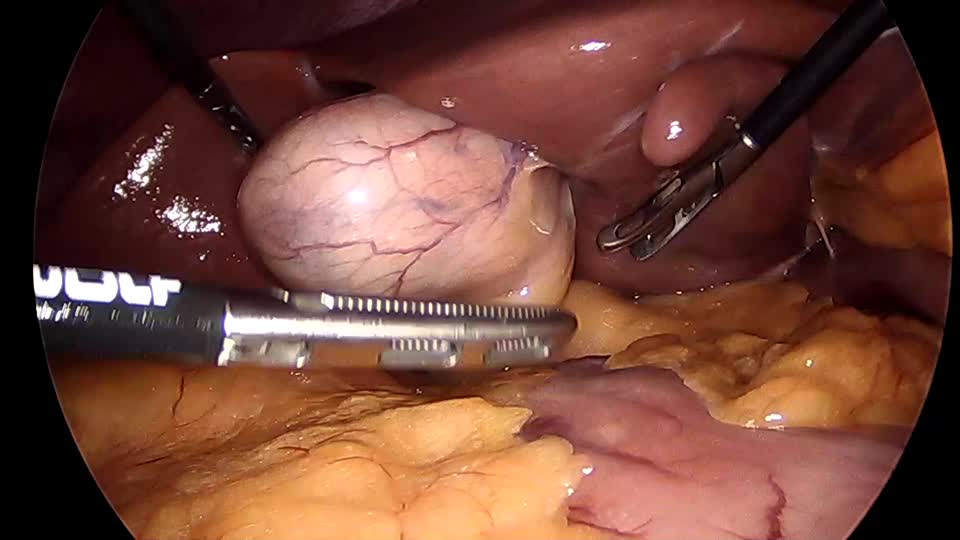 76-11-312倉田論文　動画２　step3 