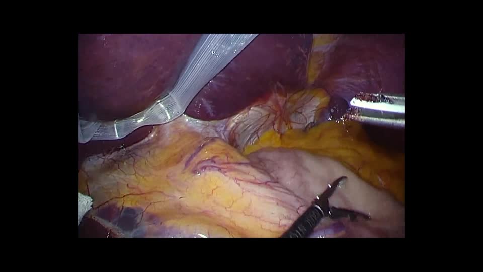 76-11-391矢野論文　動画１　図２
