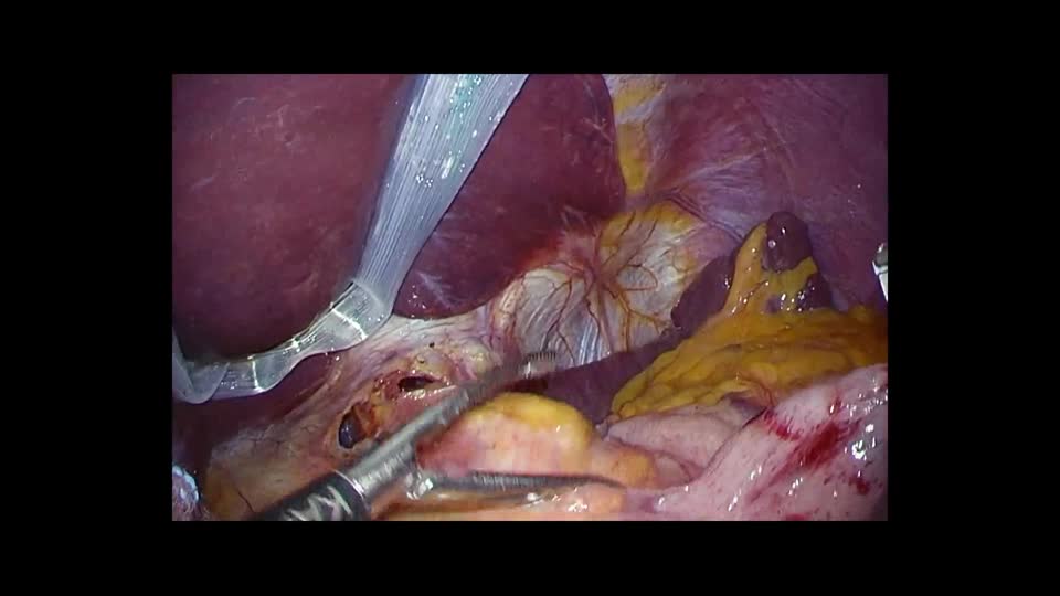 76-11-392矢野論文　動画２　図３