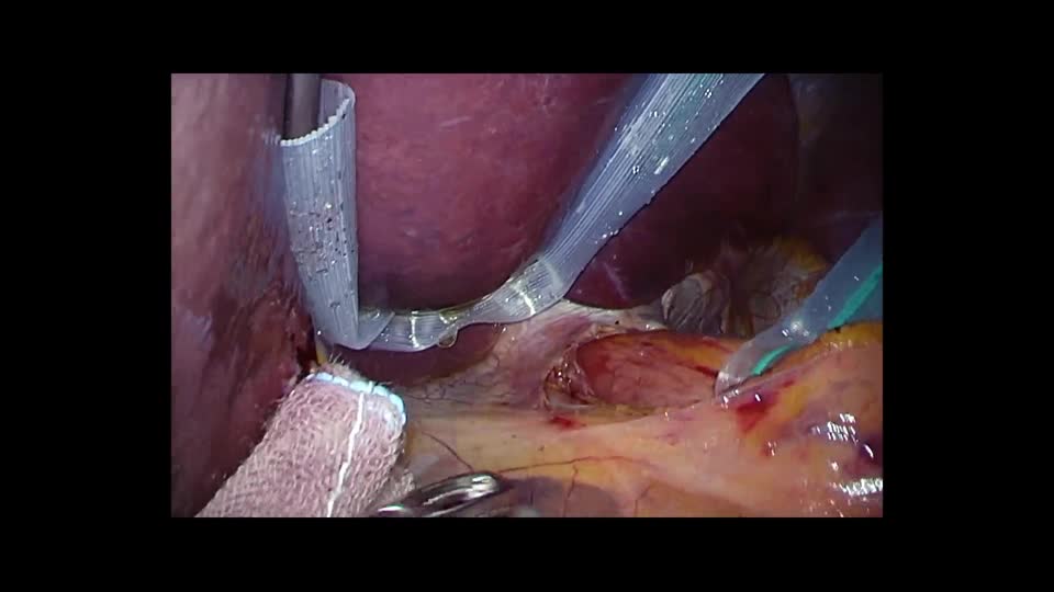 76-11-393矢野論文　動画３　図４