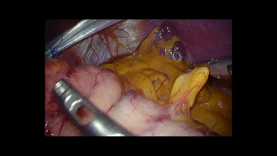 76-11-394矢野論文　動画４　図６
