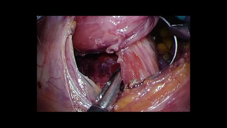 76-11-396矢野論文　動画６　図９