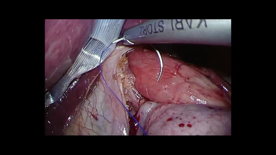 76-11-397矢野論文　動画７　図10