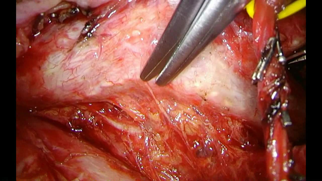 76-11-024白石論文動画4図7