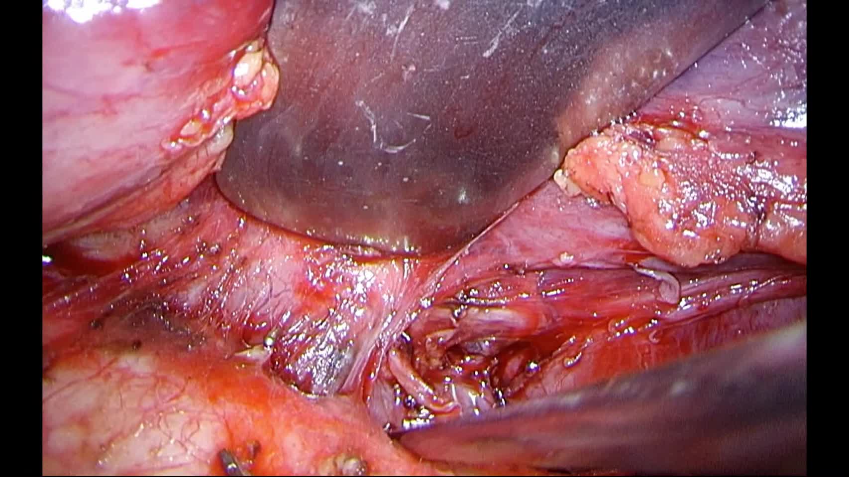 76-11-023白石論文　動画3図6