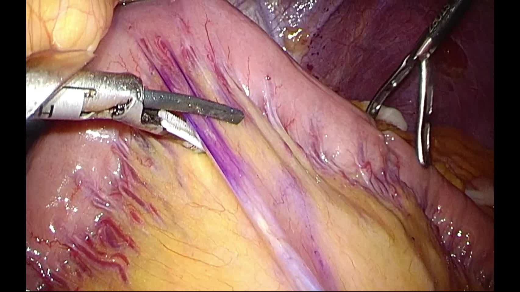 76‐11‐055伊藤論文　動画5図5
