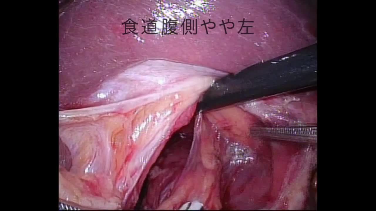 76-11-041森論文　動画8図8