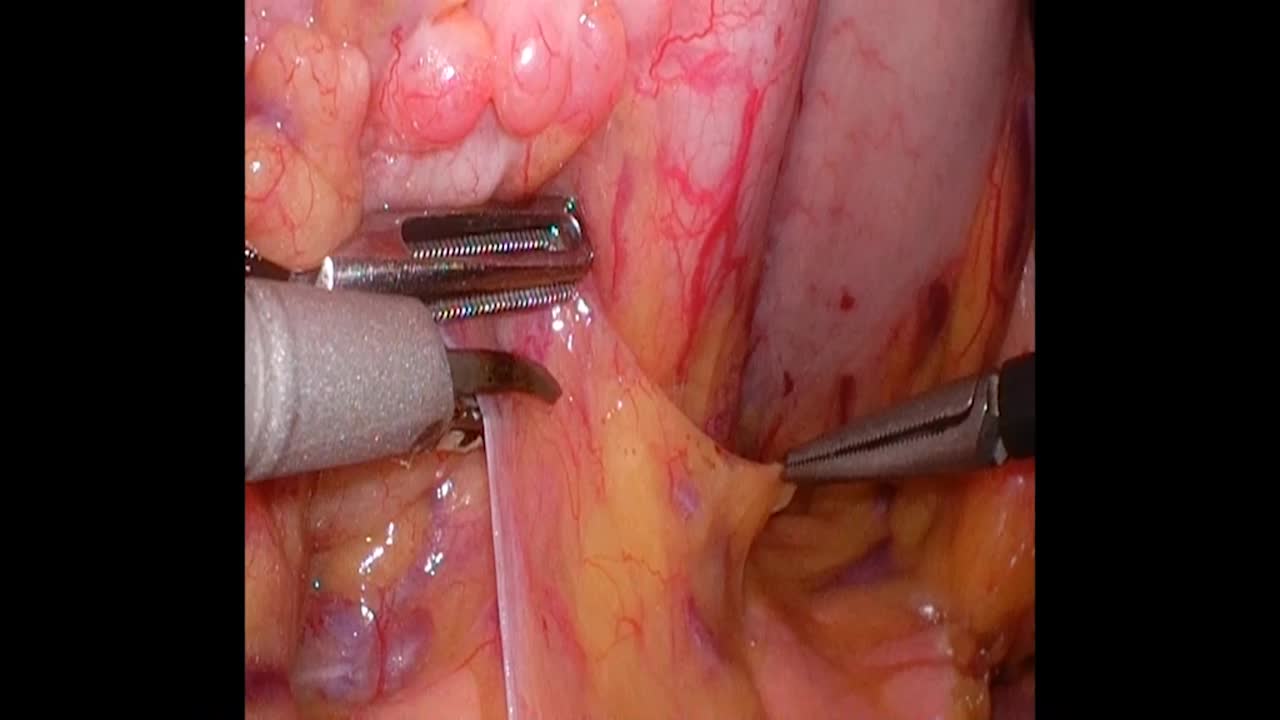 76-11-064江原論文　動画4図8～10