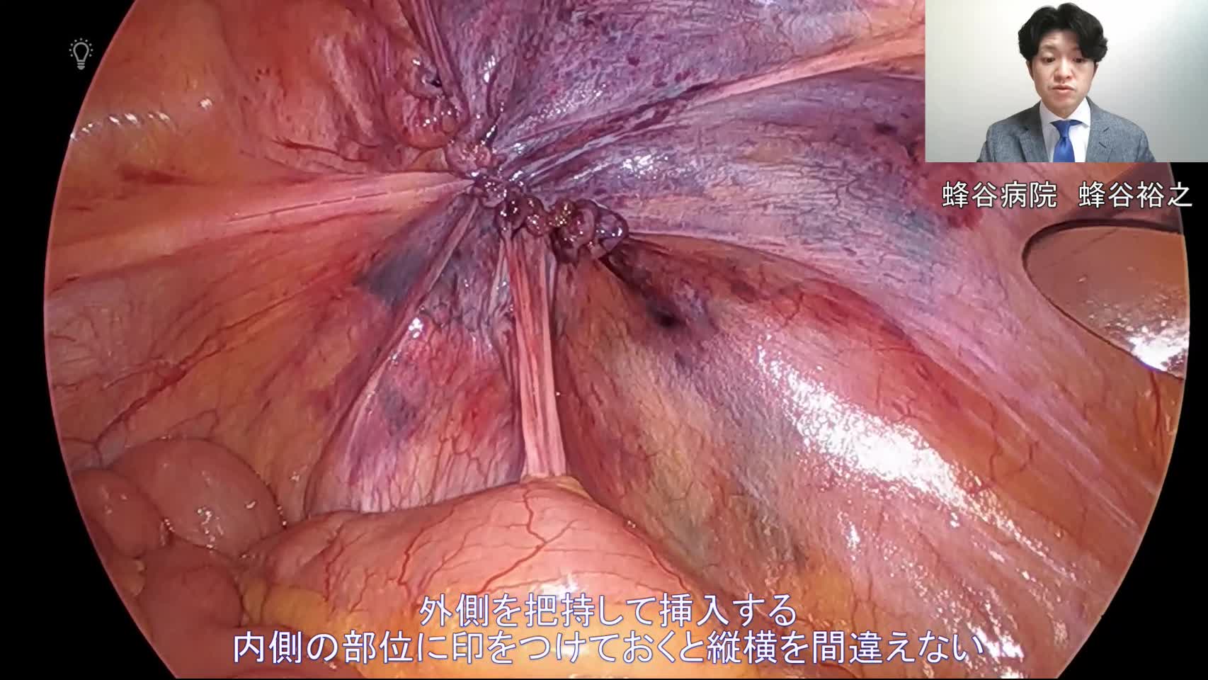 WK2102蜂谷論文　動画１　音声解説付