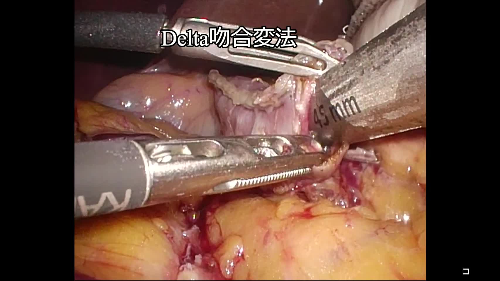 wk2104小倉論文　初回投稿時0914　吻合動画...