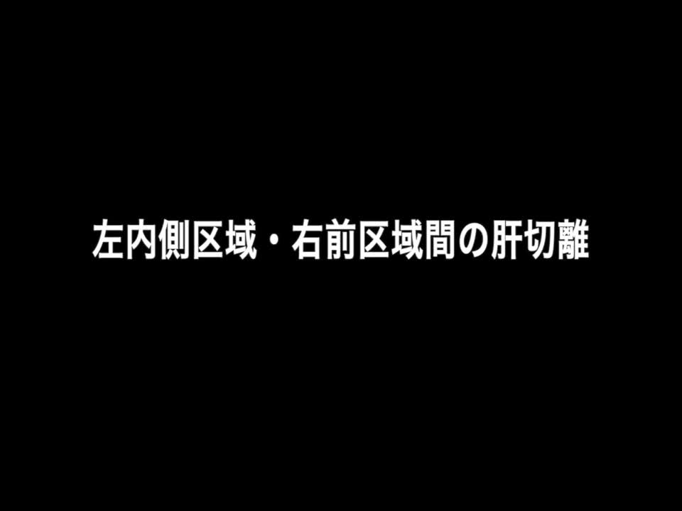 76-11-275藤本論文　図５　肝離断１