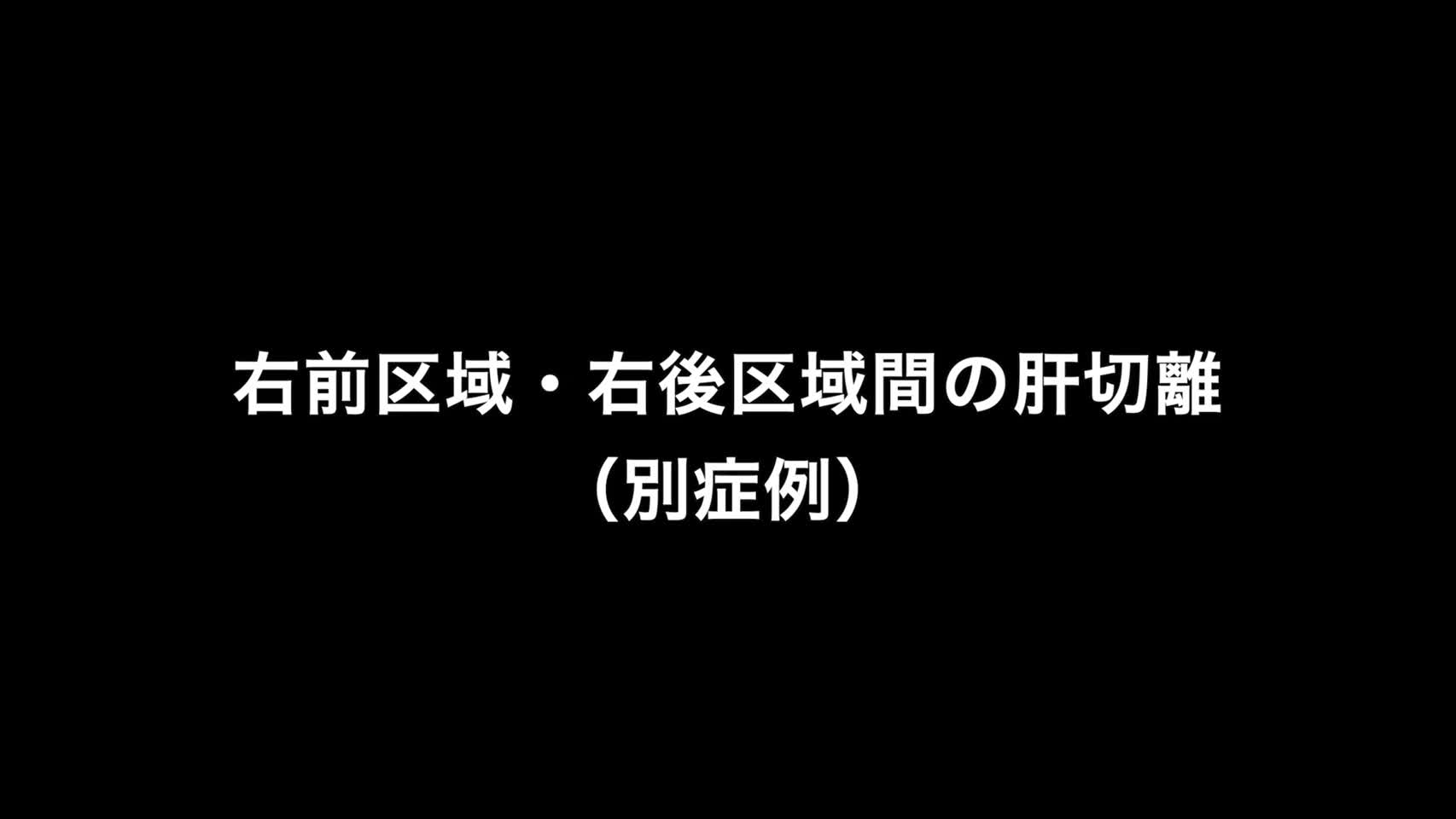 76-11-276藤本論文　図６　肝離断２