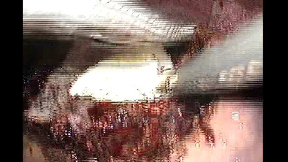 77-04-w041中村論文　動画１