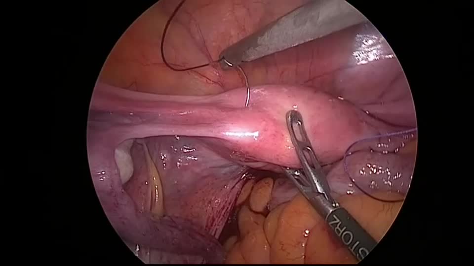 kd770502藤井論文　動画２