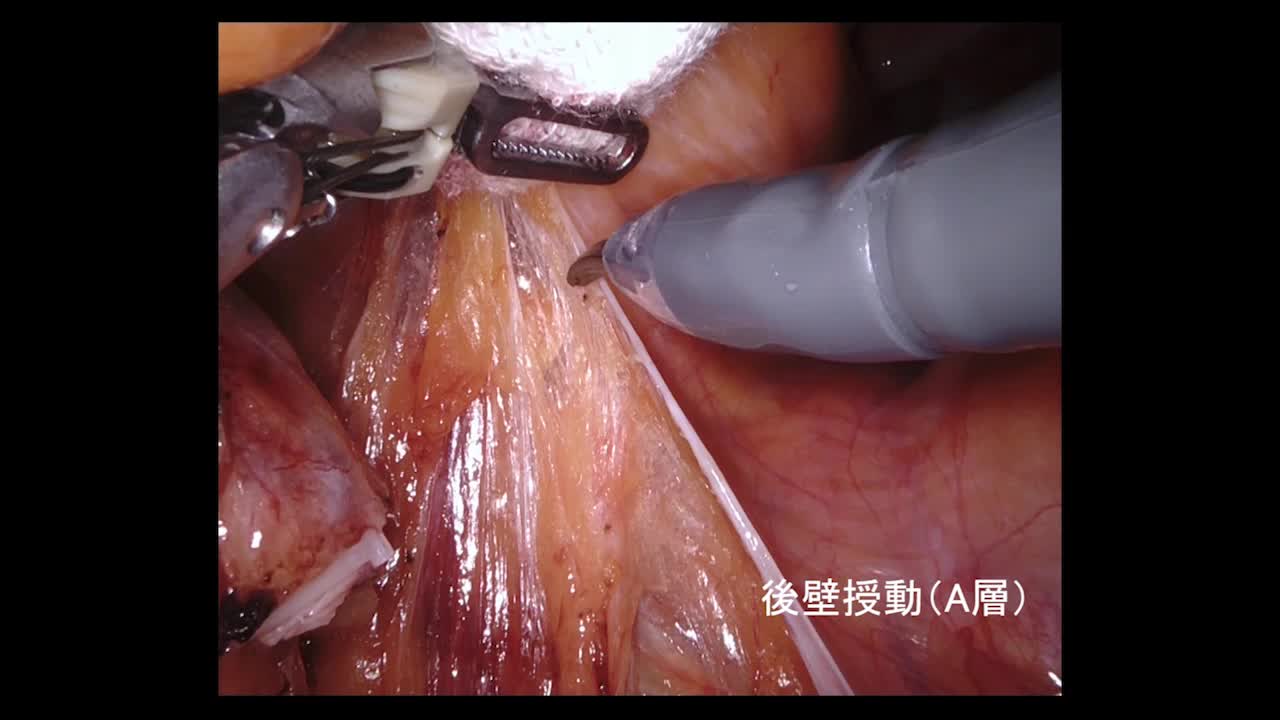77-11-181笠井論文　動画1図8