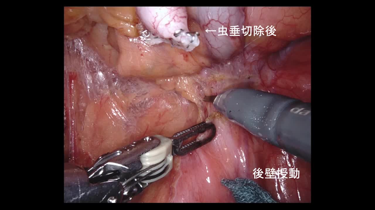 77-11-182笠井論文　動画2図9