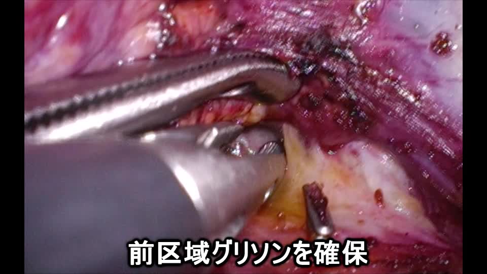 77-11-333門田論文　動画３　図9