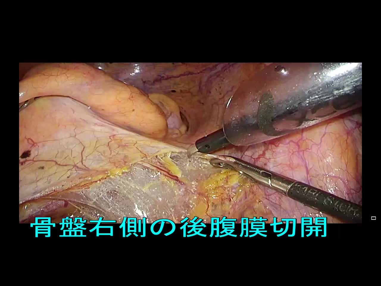77-11-201松田論文　動画1