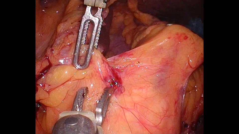 78-02-054出村論文　動画４　図４A　Para-axial setup...