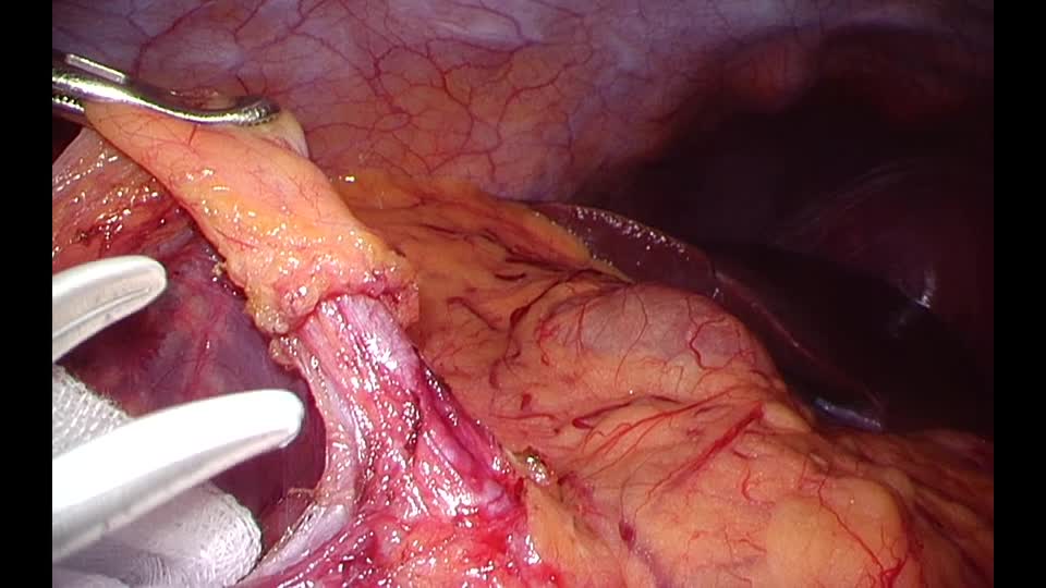 78-02-081茂原論文　動画１　図２